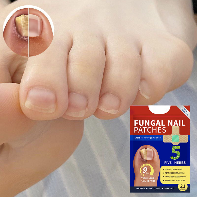 Fungal Nail Patches (21 pcs/box)