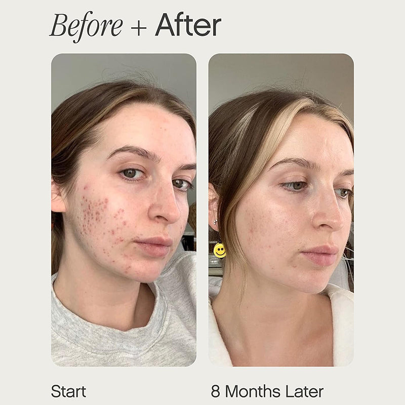 Brightening & Balancing Buttery Cream