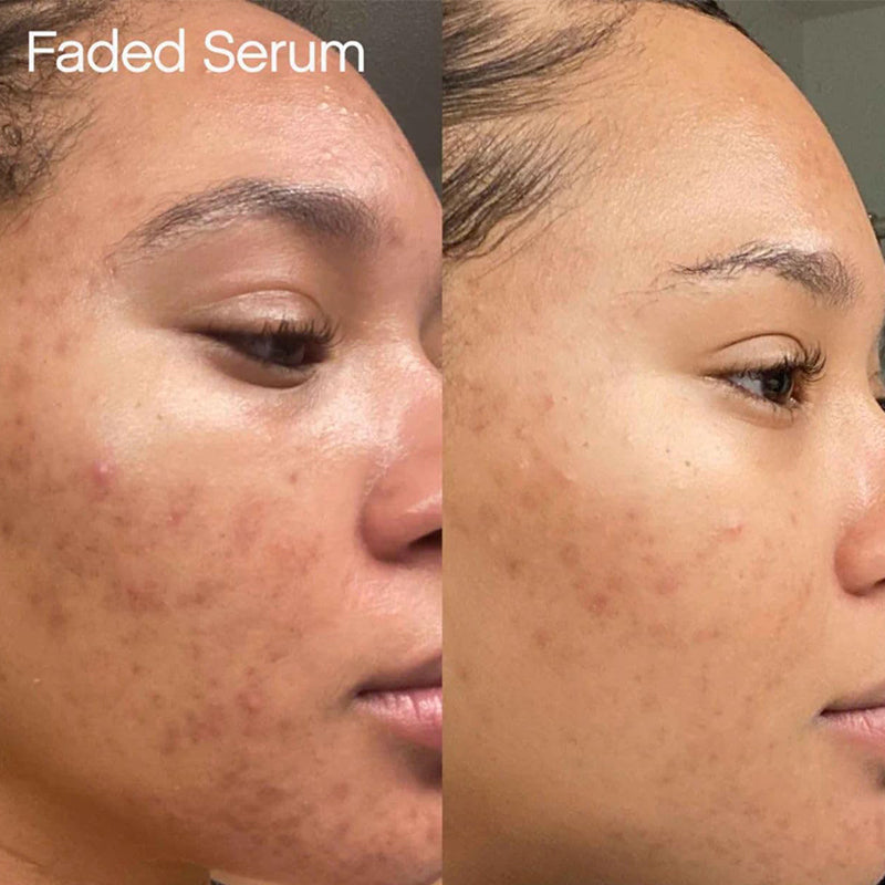 Brightening & Balancing Buttery Cream