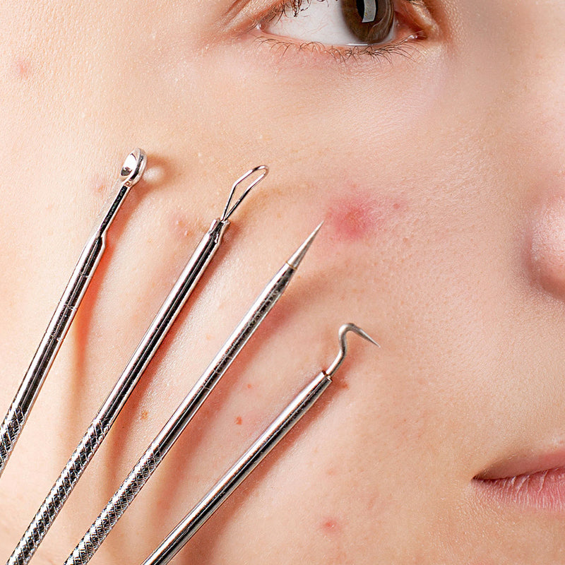 Blackhead & Pimple Removal Tool - Deep Cleansing