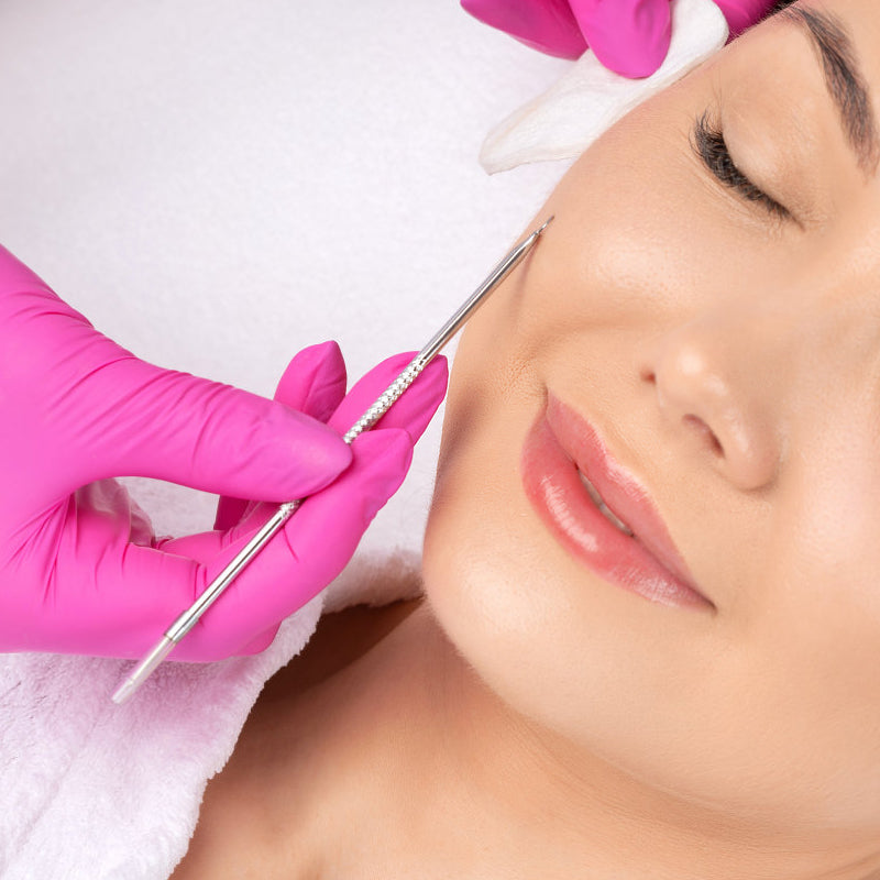 Blackhead & Pimple Removal Tool - Deep Cleansing