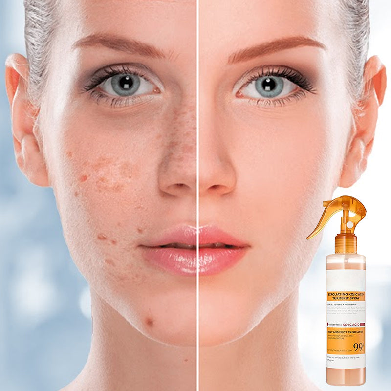 Exfoliating Kojic Acid Turmeric Spray