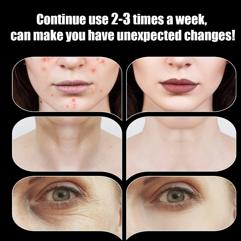 Portable Skin Therapy Machine with 6 Neon & Argon Wands