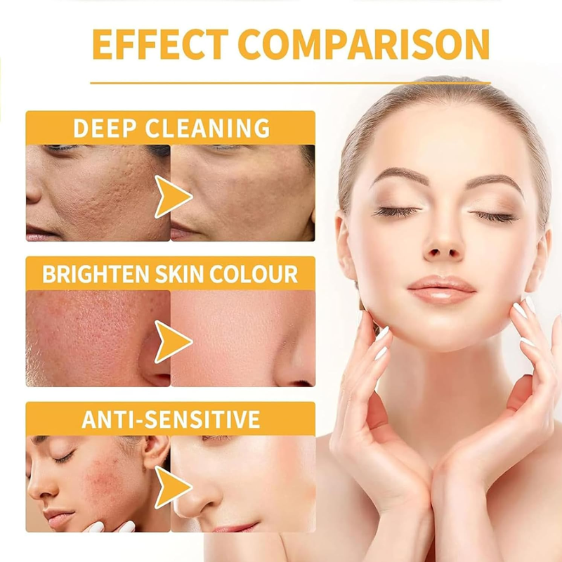 Exfoliating Kojic Acid Turmeric Spray
