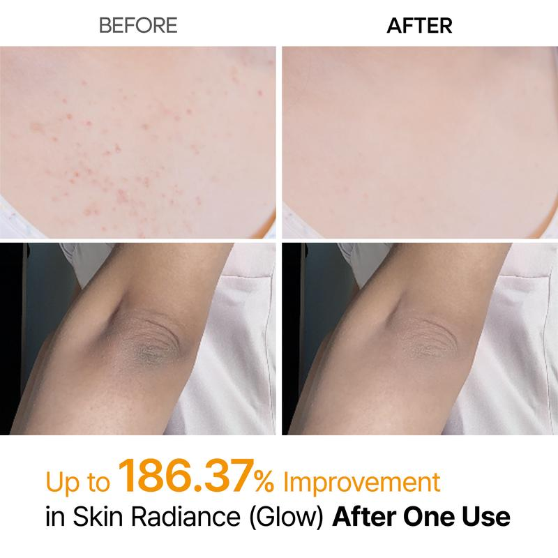 Exfoliating Kojic Acid Turmeric Spray