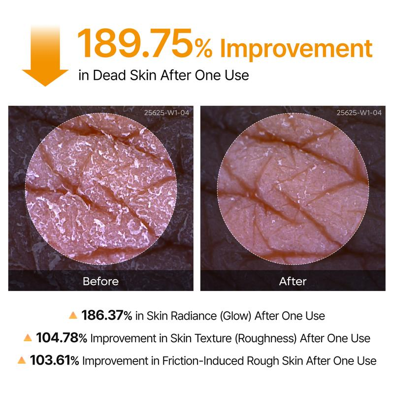 Exfoliating Kojic Acid Turmeric Spray
