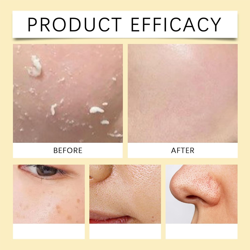 Exfoliating Kojic Acid Turmeric Spray