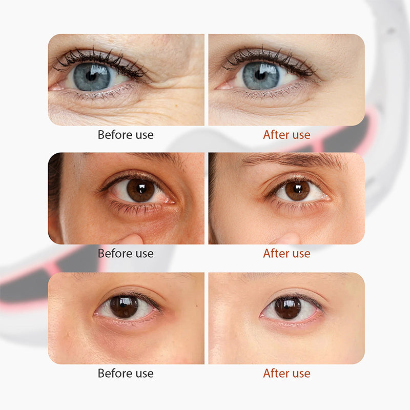 Microcurrent Eye Massager with Red Light Therapy