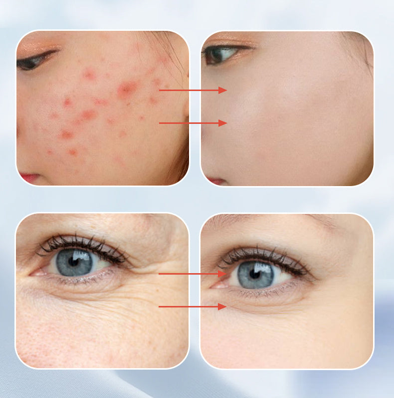 Portable Skin Therapy Machine with 6 Neon & Argon Wands