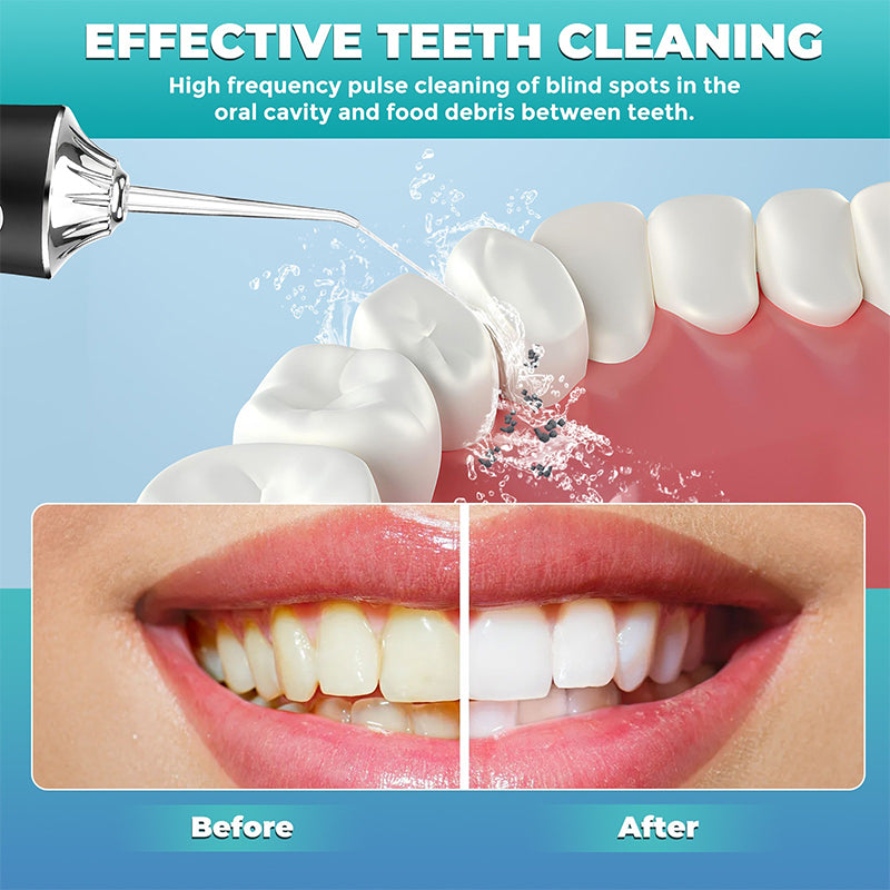 Rechargeable Electric Plaque Remover