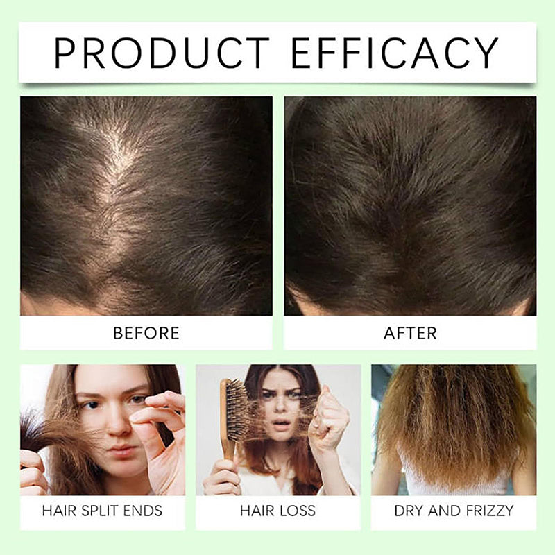 Anti-Hair Fall Hair Loss Shampoo