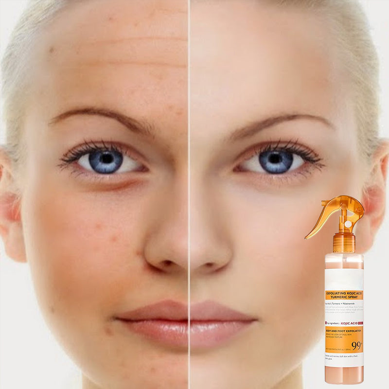 Exfoliating Kojic Acid Turmeric Spray