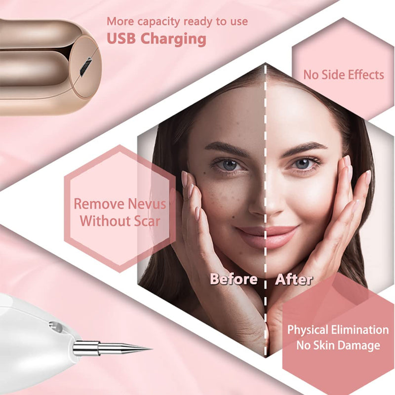 UV LED Mole & Spot Remover Pen