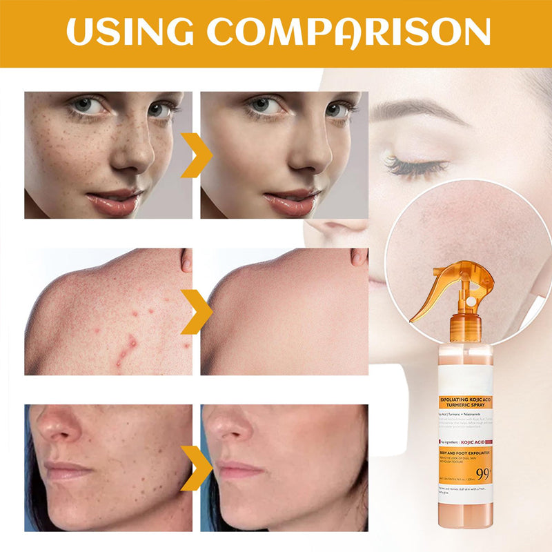 Exfoliating Kojic Acid Turmeric Spray