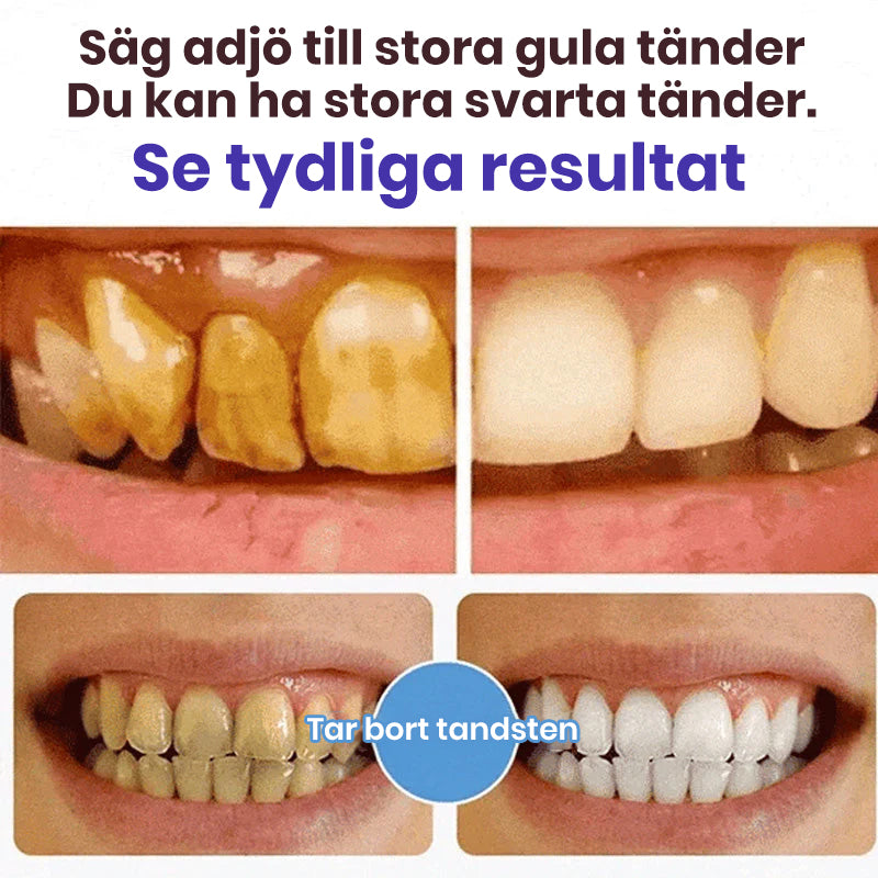 Super Probiotic-6 tandkräm