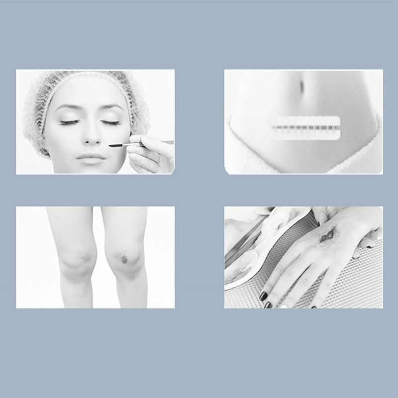 Emergency Wound Closure Strips