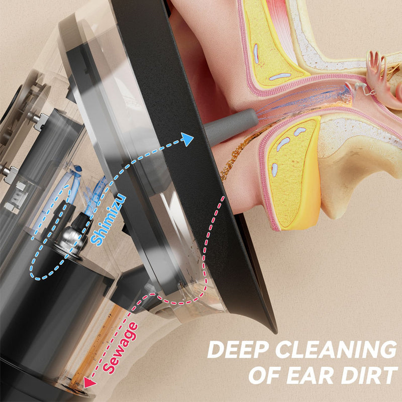 Electric Ear Wax Removal