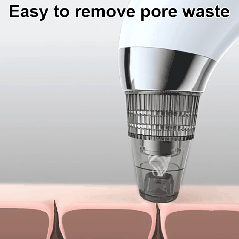Professional Vacuum Blackhead Remover
