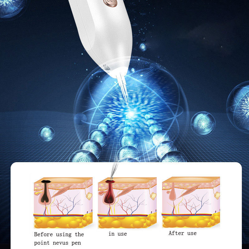 UV LED Mole & Spot Remover Pen