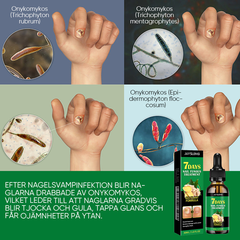 Ingefära nagelbehandling
