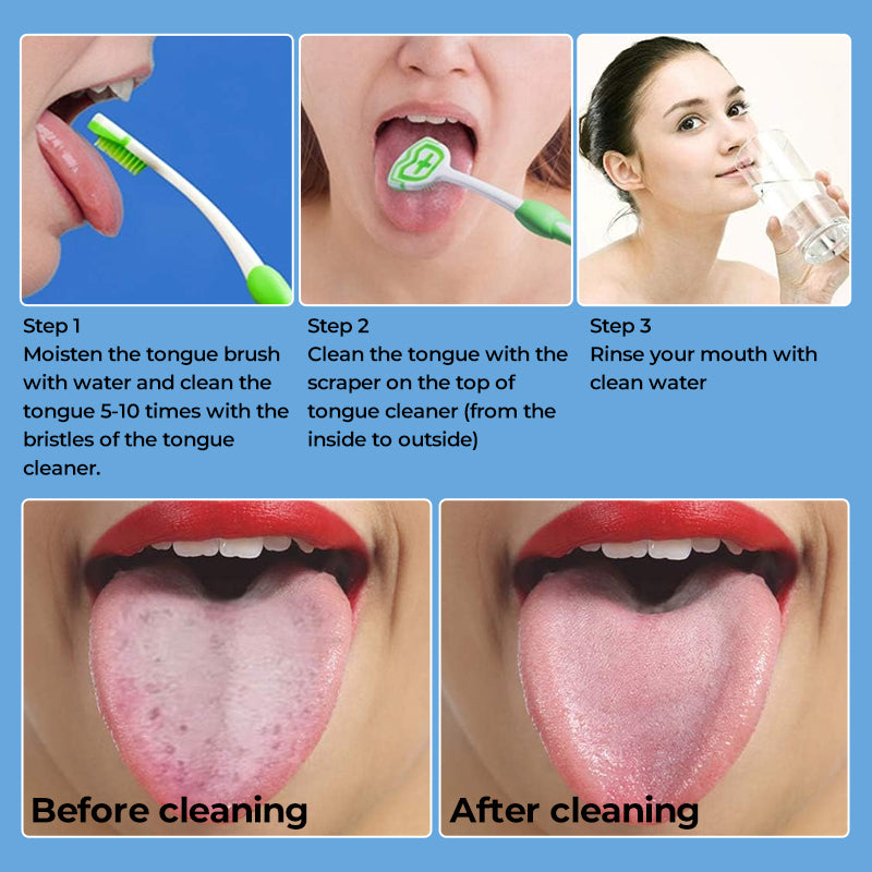 Tongue Cleaners
