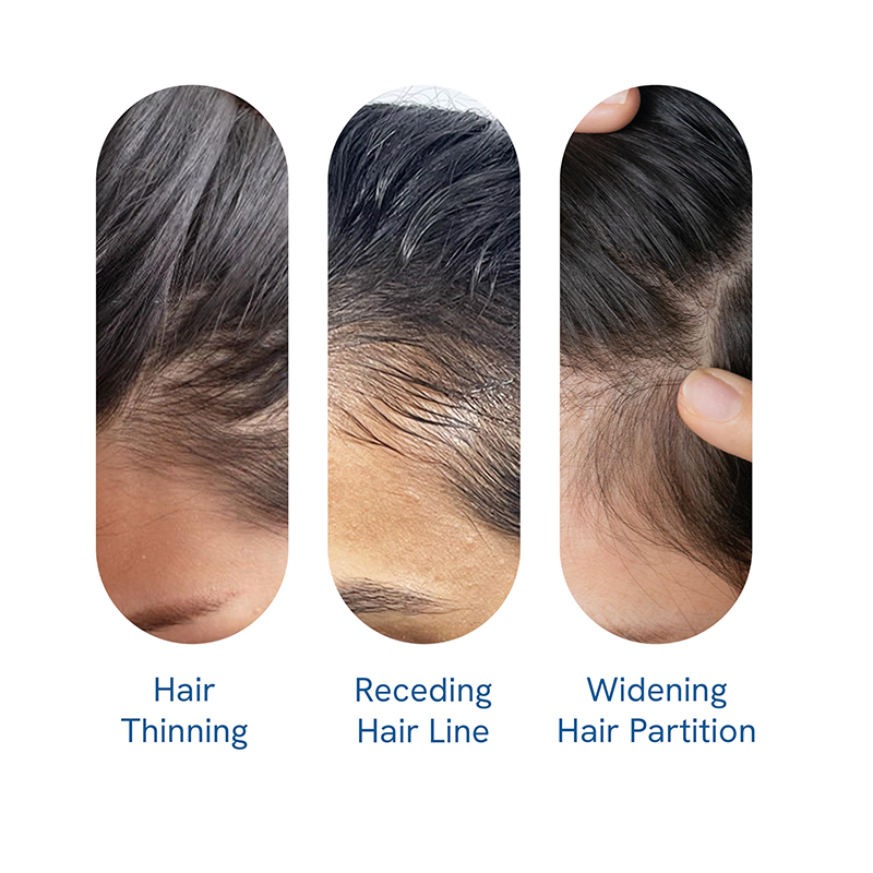 Advanced Hair Growth Roll-On Serum