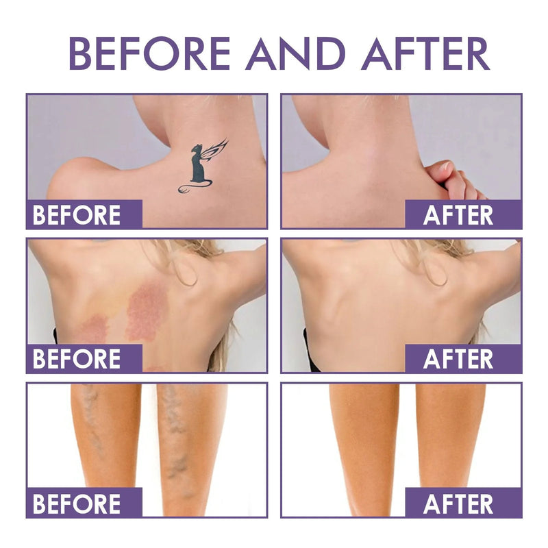 Body Coverage Perfector – Waterproof Leg & Body Makeup