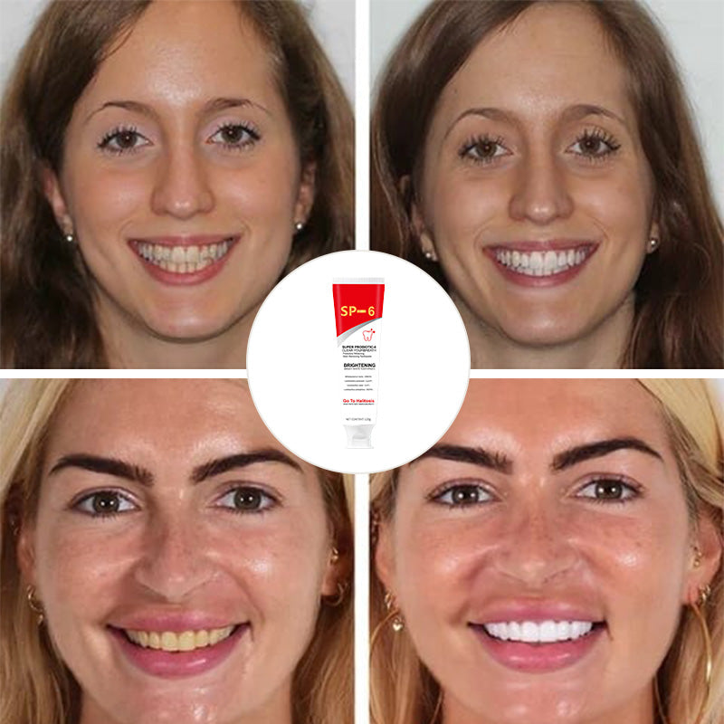 Super Probiotic-6 tandkräm