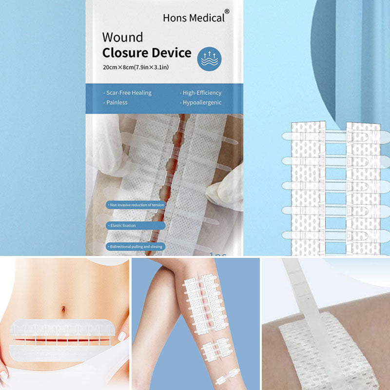 Emergency Wound Closure Strips