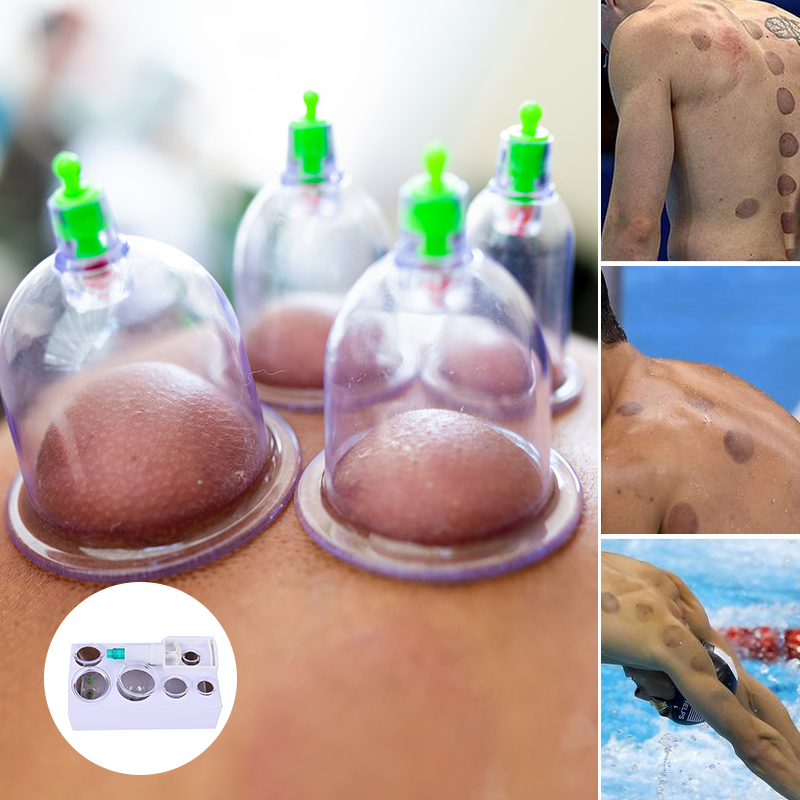Cupping Set For Massage Therapy
